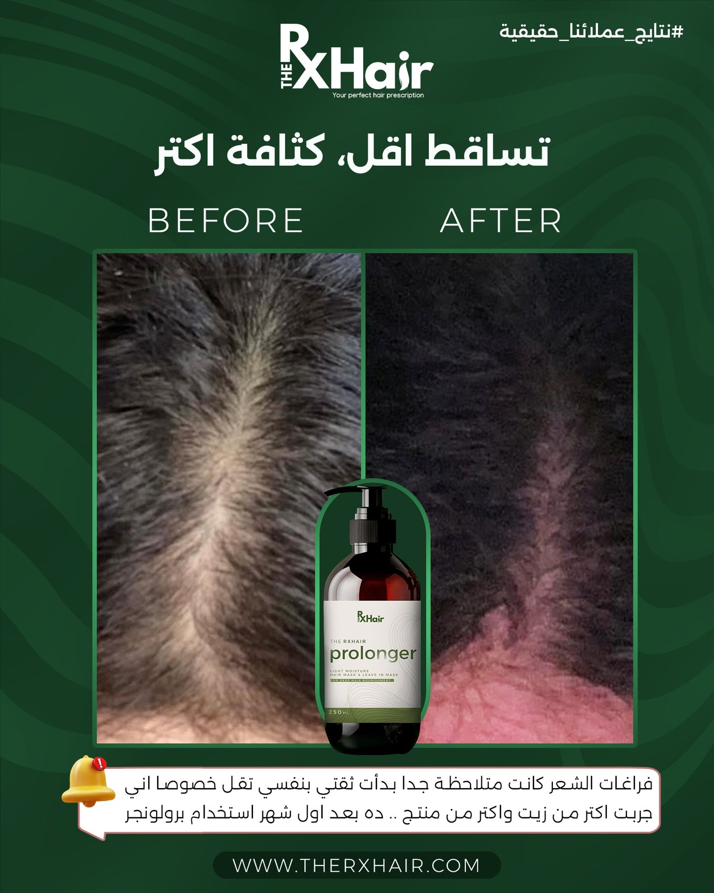 Prolonger لشعر اطول
