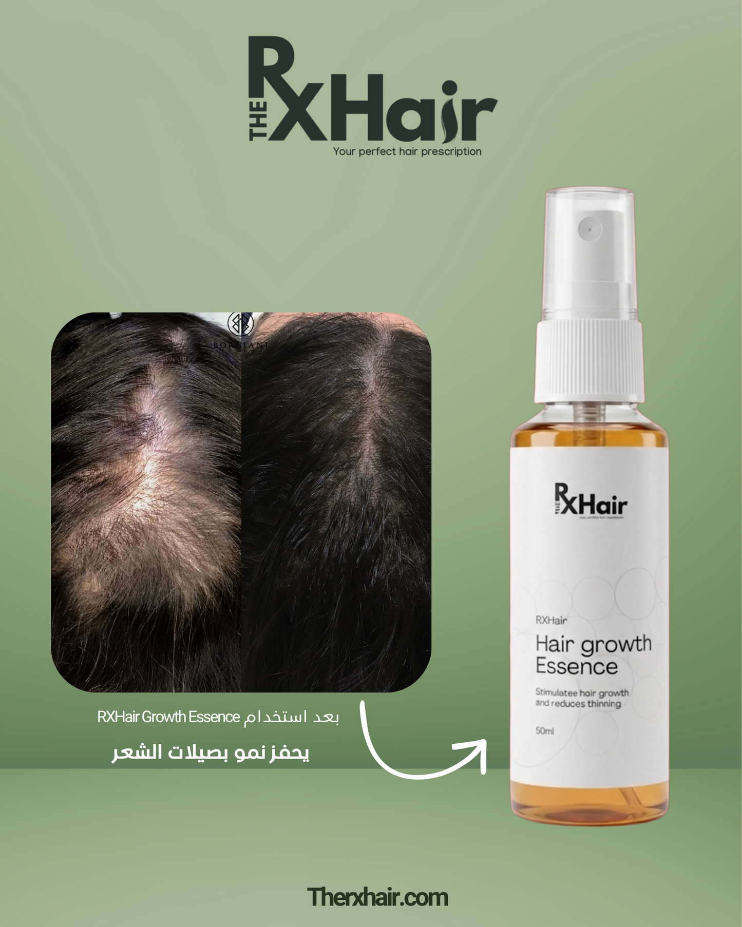 Derma Stamp + Free Growth Essence