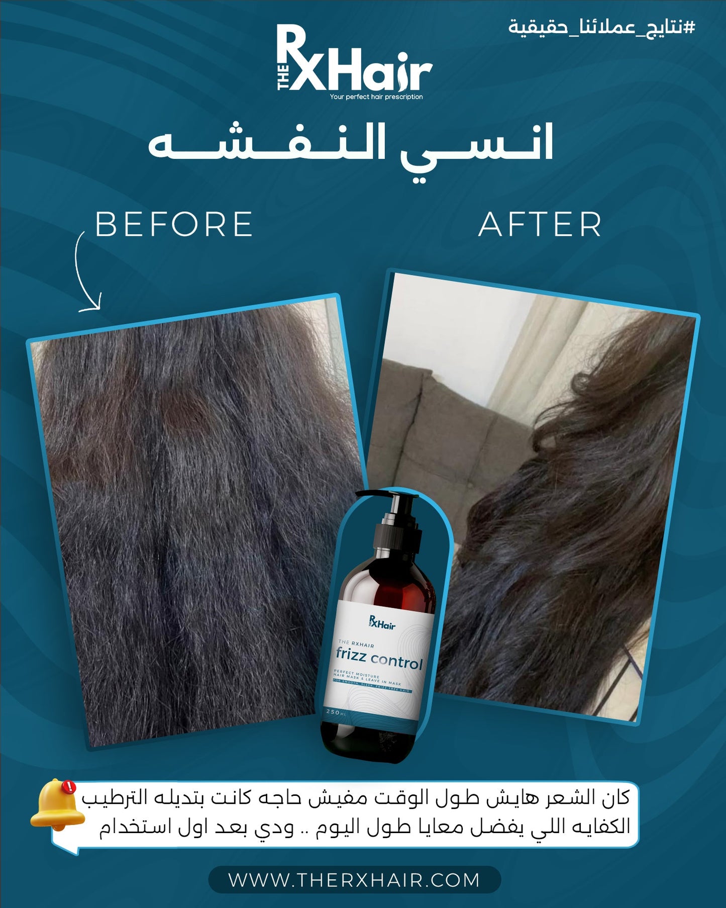 Frizz Control لشعر انعم