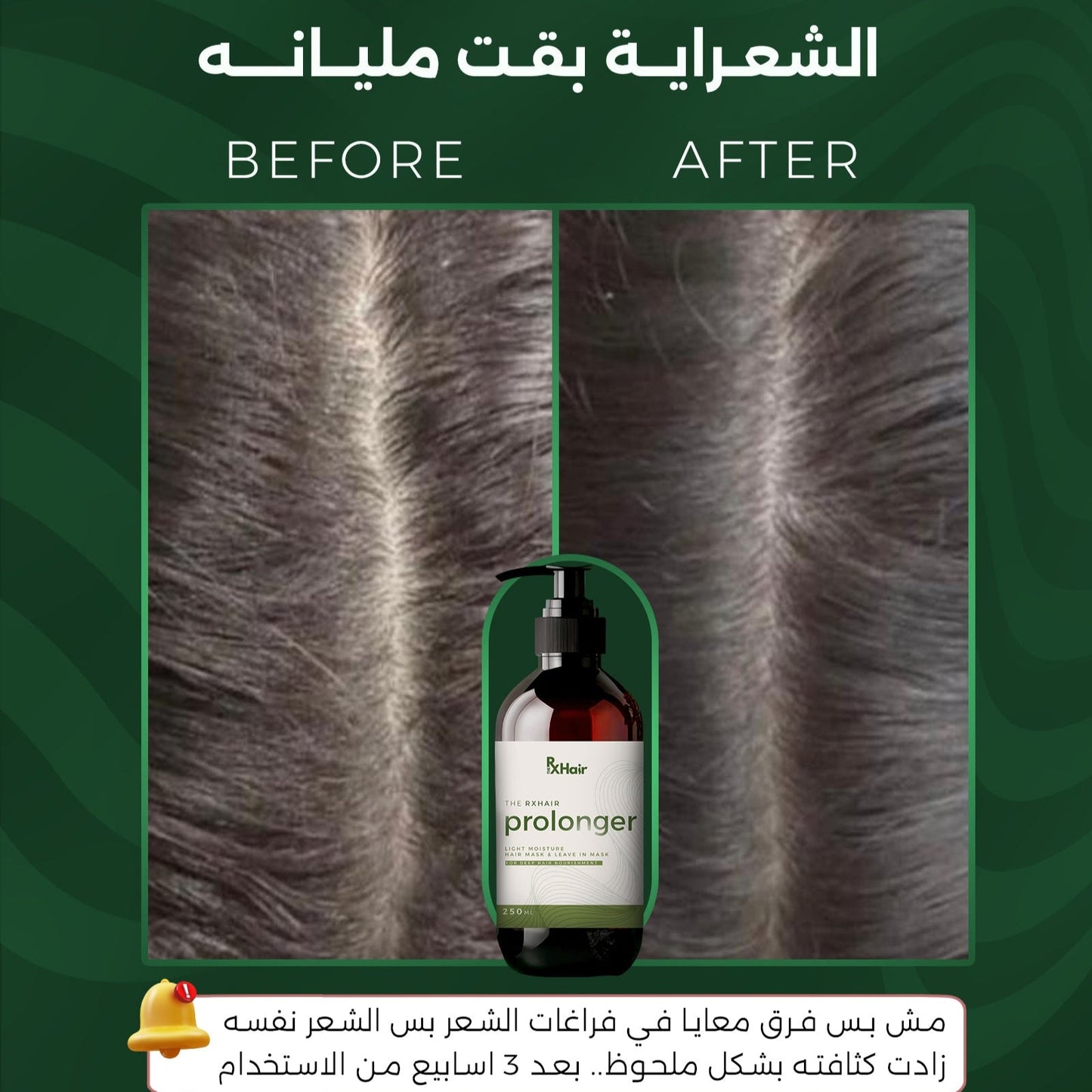 Prolonger لشعر اطول
