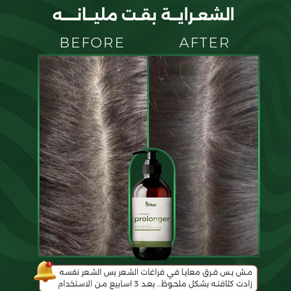 Prolonger لشعر اطول