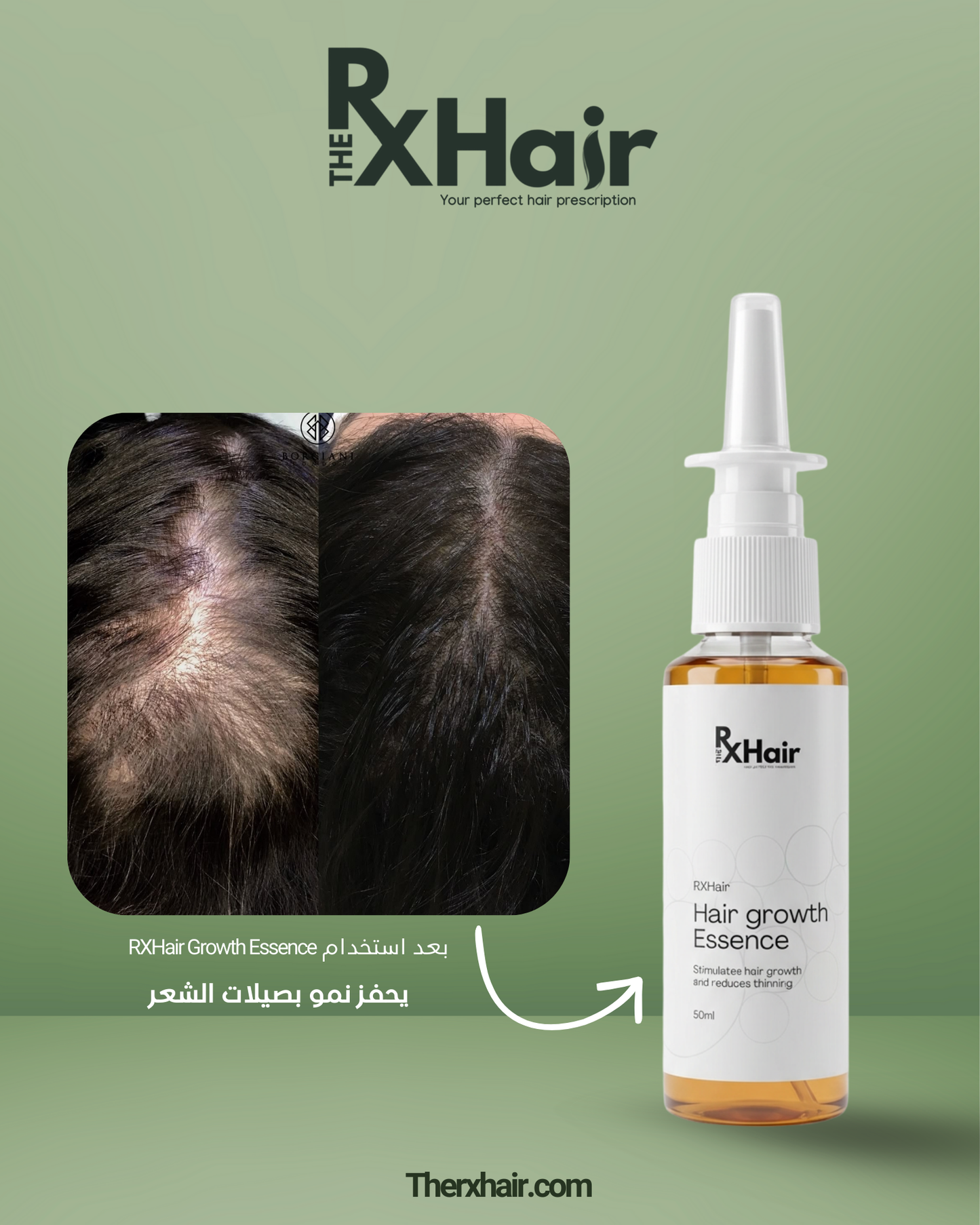 RXHair Growth Essence